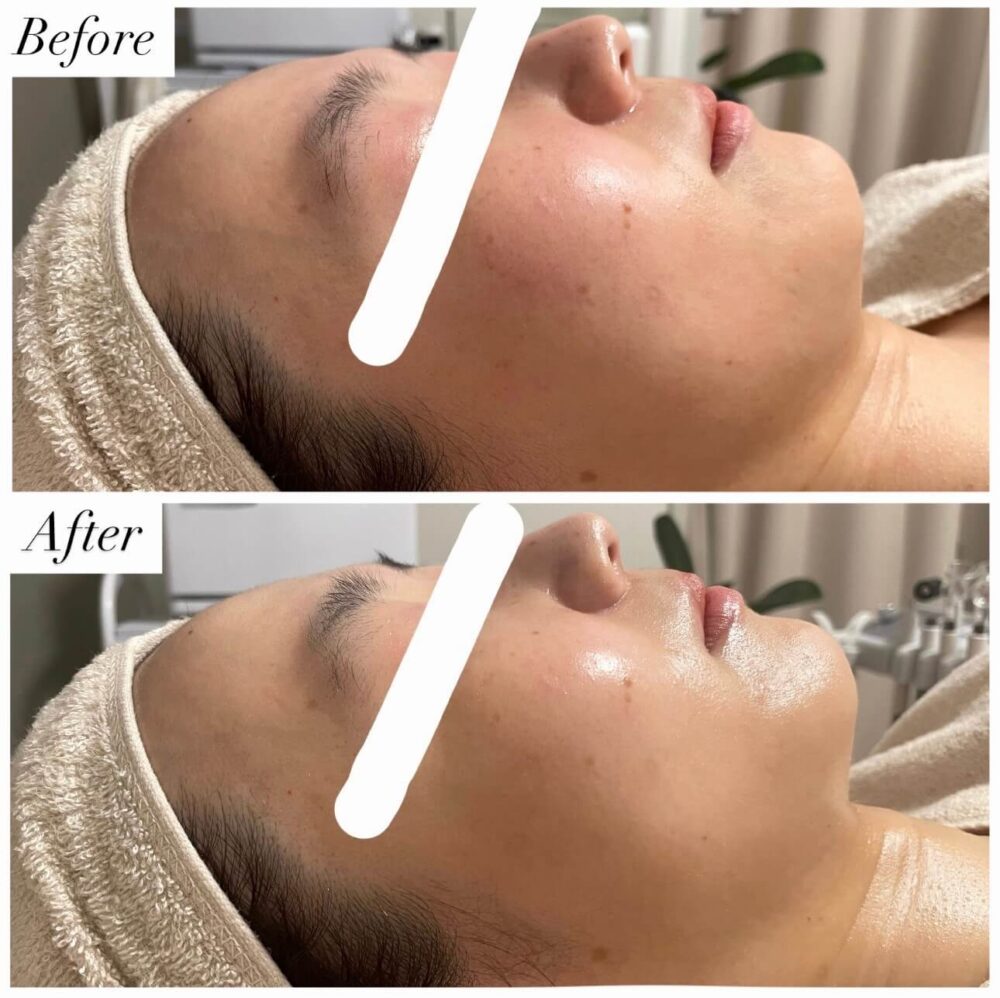 Before After1