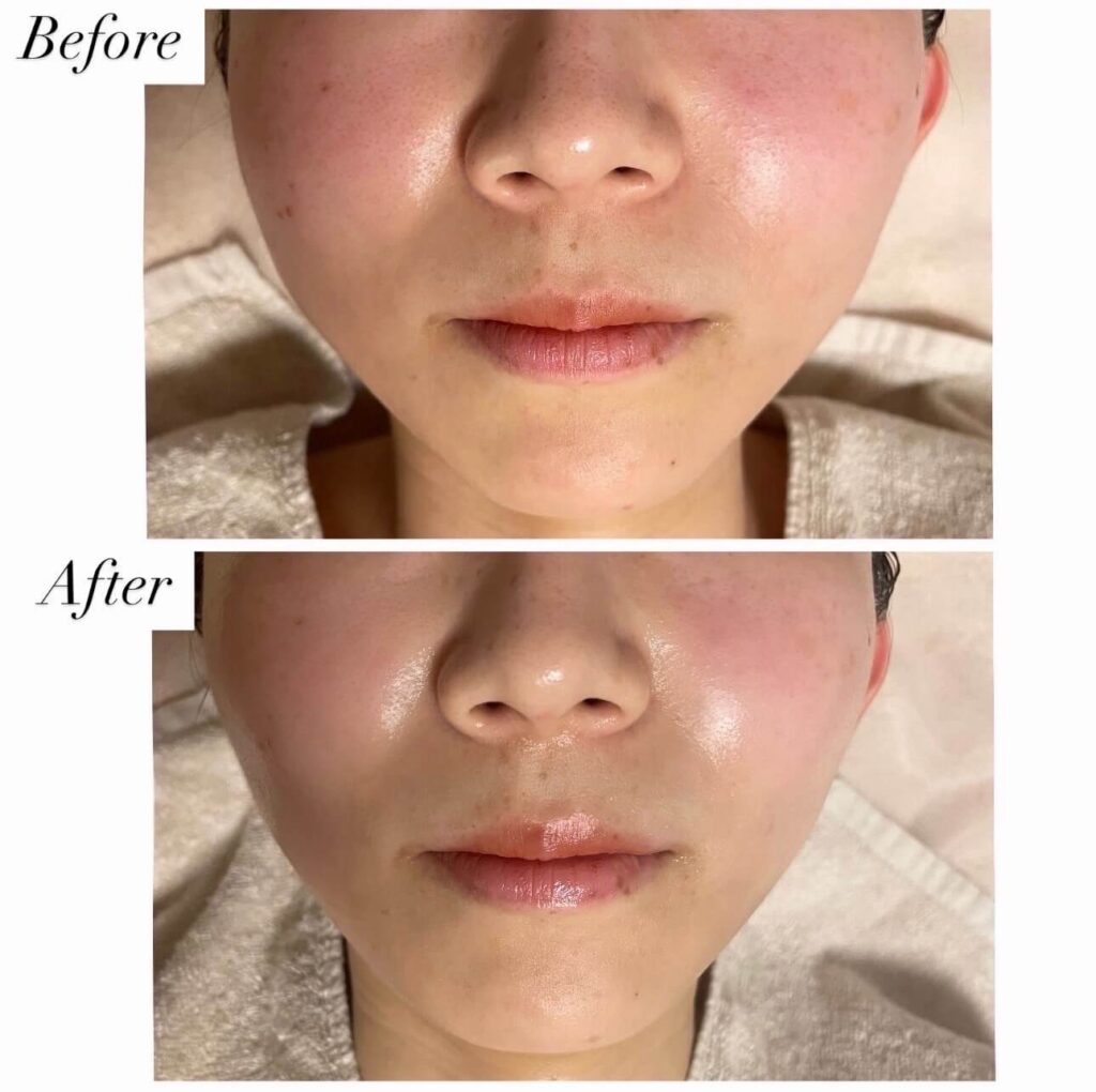 Before After2