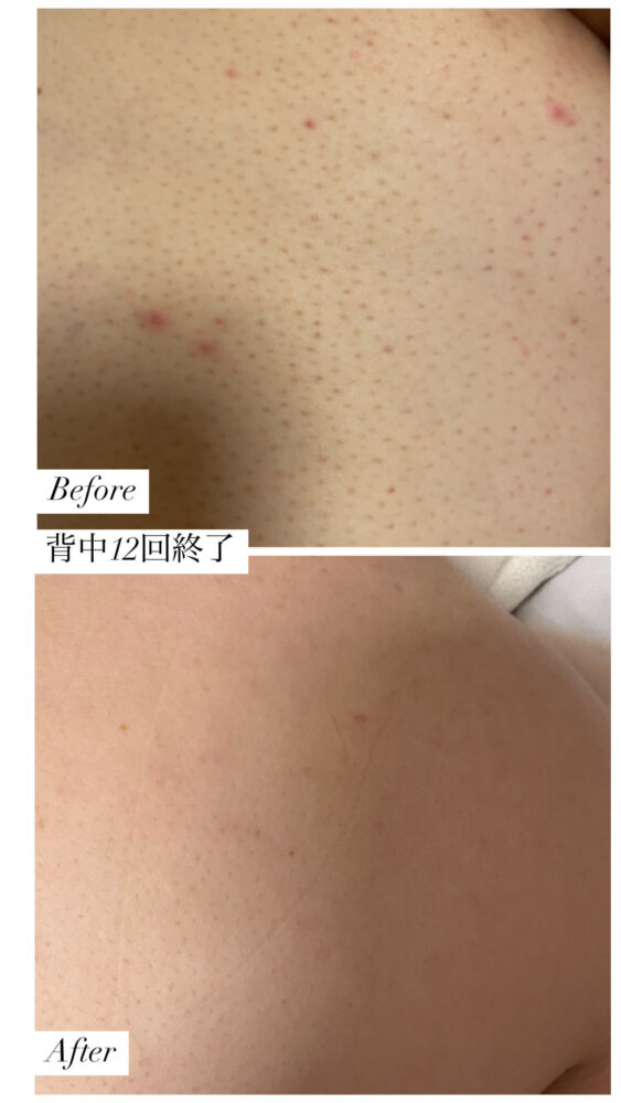 Before After3