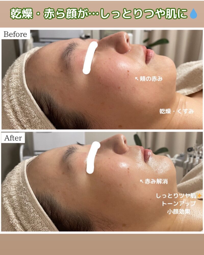 Before After1