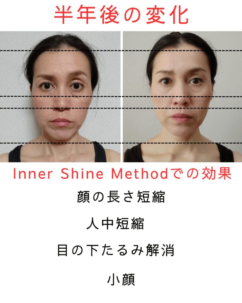 BeforeAfter1