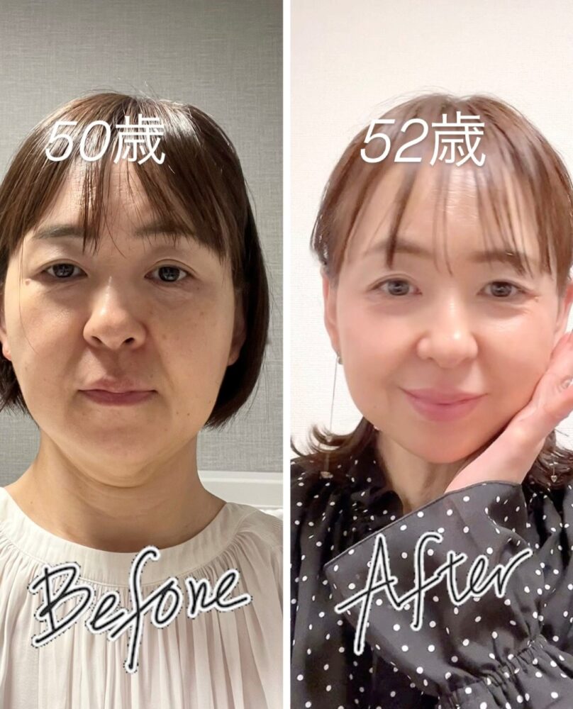 美顔ヨガによる表情の変化イメージ｜50歳から52歳のビフォーアフター