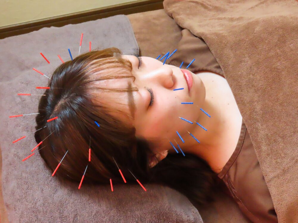 美容鍼と鍼灸で心身を整える高円寺のプライベートサロン施術風景