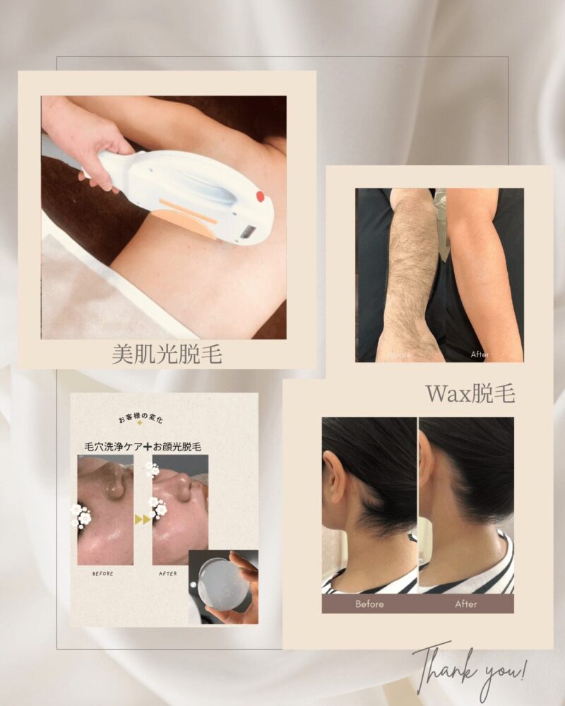 脱毛専門店CREAの光脱毛・WAX脱毛・毛穴洗浄ケアの施術イメージ