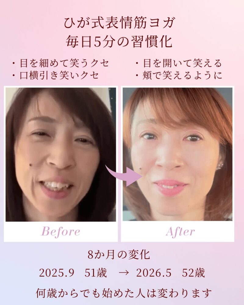 表情筋ヨガで正しい顔の動かし方を学ぶマンツーマンレッスン
