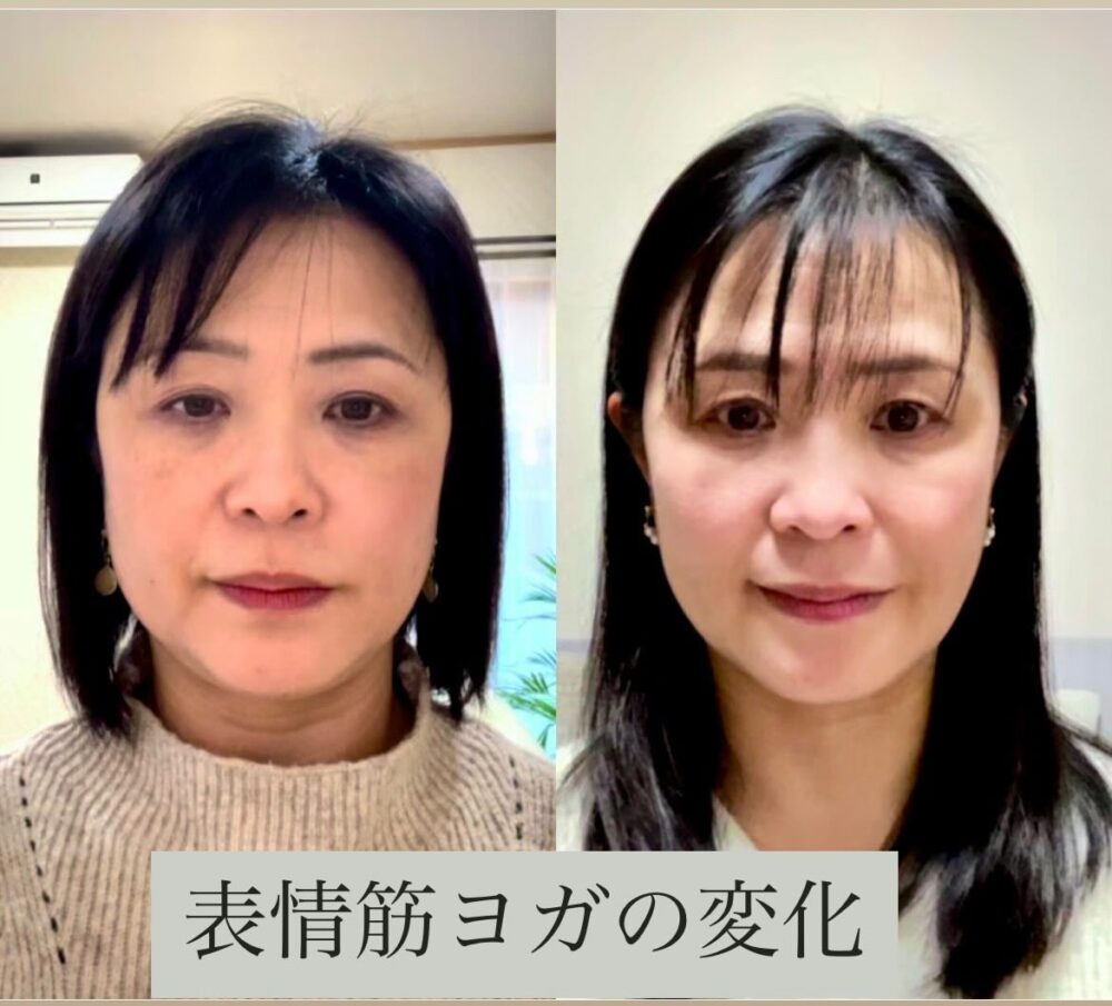 華祐のオンライン表情筋ヨガによる顔まわりの変化イメージ