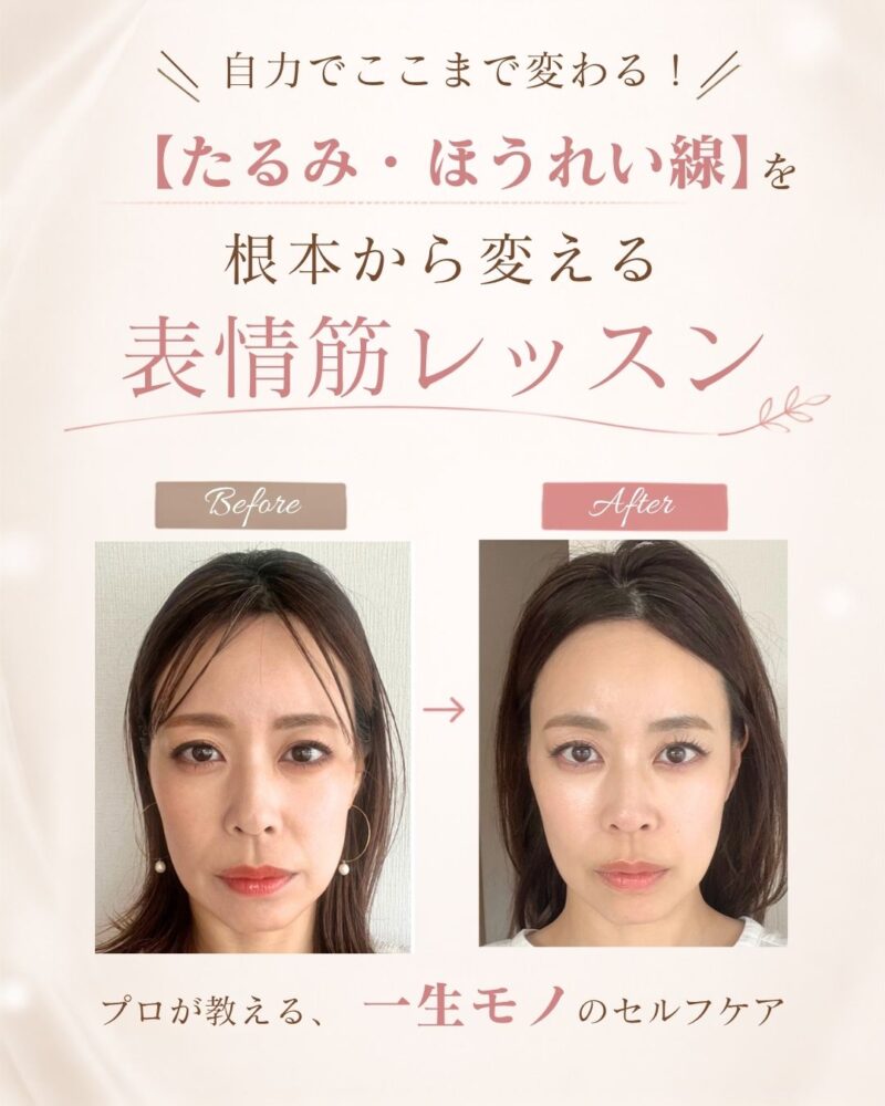 表情筋・舌・呼吸を取り入れた美表情ケアの紹介