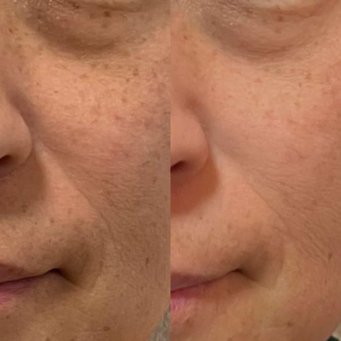 シミ・くすみ・年齢肌が気になる方の肌ケアイメージ｜福麗Pharm beauty lab FUKUOKA